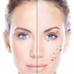 amarose remover Profile Picture