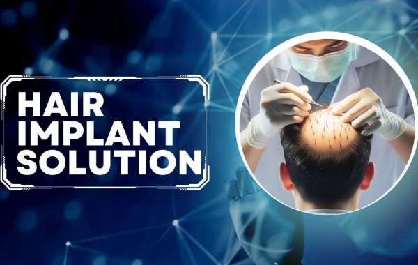 Factors to Choose the Right Hair Implant Solution