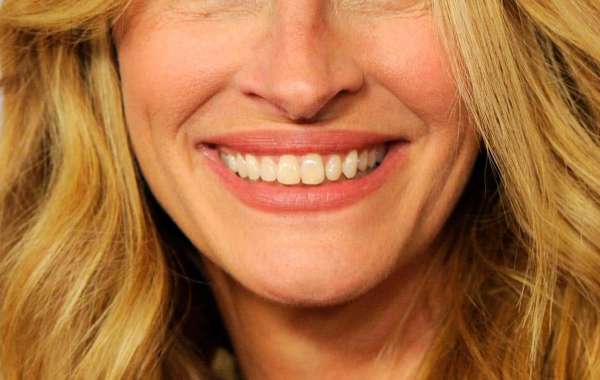 Newport Beach Experts Reveal How to Smile Confidently with Top and Bottom Teeth